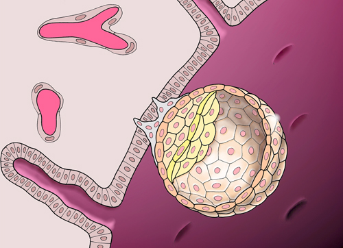 Prostatitis psa test - PSA - Mit kell tudni róla?