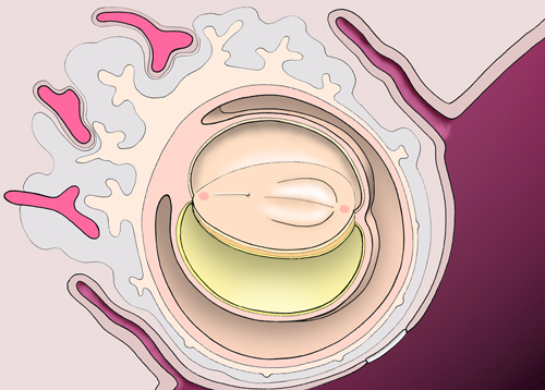 Prostatitis psa test